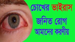 চোখের ভাইরাস জনিত রোগ ও আমাদের করণীয়  II Dr. Plabon Bosu II Ophthalmology II AAMC II Health Tips