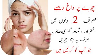 Treatment of Spots on the face | چہرے پر داغ دھبے ختم کیسے کریں | skin care | acne treatment