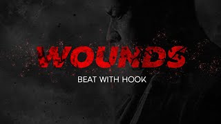 "Wounds" (with hook) | Rap Beat With Hook - trap rap instrumental