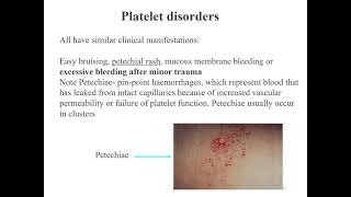 Physiology (BMN1007) L4: Anti-clotting and disorders of haemostasis