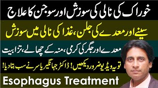 Ghiza ki Nali ki Sozish | Khurak ki nali ki Sujan | Maday aur seene ki jalan | Esophagus Treatment