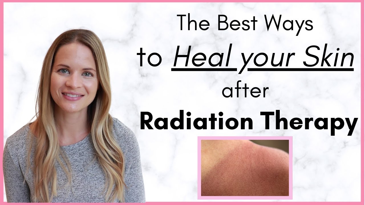 Skin Care After Radiation Therapy - The Best Ways To Recover And Heal ...