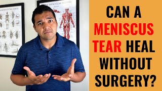 Top 4 Causes Of Knee Meniscus Tears