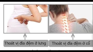 Bệnh thoát vị đĩa đệm là gì? Dấu hiệu \u0026 chữa khỏi bệnh thoát vị đĩa đệm