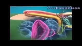 Penile Implant Surgery Treatment India Producer With Animation Videos