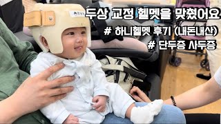 헬멧을 맞췄어요 | 단두증 사두증 | 쌍둥이 육아