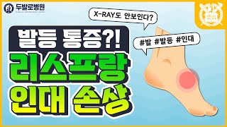 [발 통증] 발등 리스프랑 인대 손상? 리스프랑 진단과 치료