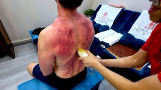 She Went Too Far... Intense Gua Sha ASMR Massage! 😳😱