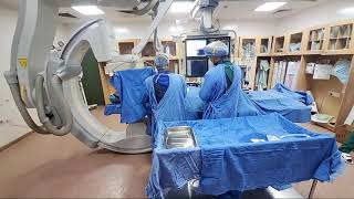 Live Varicocele Embolization Part(1)