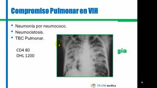 Tmmed infectología - 1 11