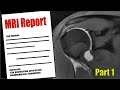 Shoulder PAIN? - Understand your MRI Report