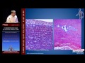 Diagnosis and Imaging of Thoracic and Abdominal Aortic Aneurysm (Mitul Patel, MD)