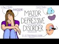 Depression Explained (Major Depressive Disorder)