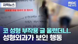 [자막뉴스] 코 성형 부작용 글 올렸더니.. 성형외과가 보인 행동 (2022.06.10/MBC뉴스)