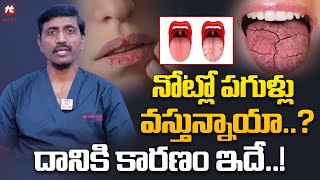 Mouth Ulcers Reasons and Treatment in Telugu నోట్లో పగుళ్లు వస్తున్నాయా దానికి కారణం@HitTVHealthtips