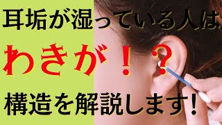 耳垢が湿っているのはなぜ？？構造を大解説!!　～体臭、ワキガ、わきが～