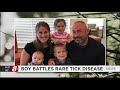 buffalo boy recovering from rocky mountain spotted fever family shares warning