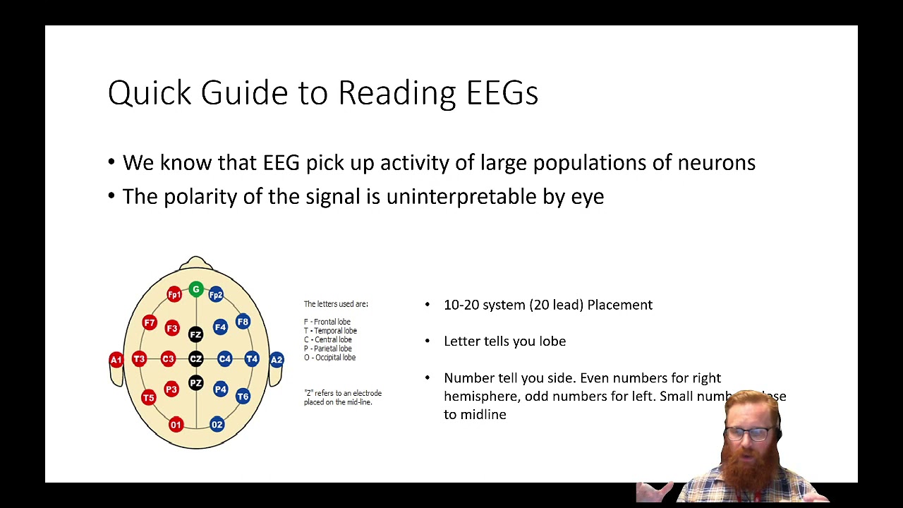 Eeg Machine Reading Electroencephalogram Eeg Johns Hopkins