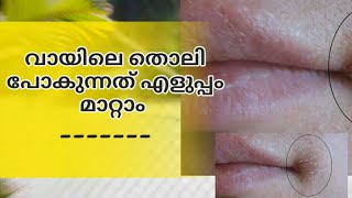 വായിലെ തൊലി പോകുന്നത് |വായിലെ അൾസർ എങ്ങനെ എളുപ്പം മാറ്റാം | Mouth ulcers Treatment.