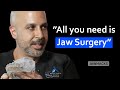 Jaw Surgery vs. MARPE: The Ultimate Solution for Airway