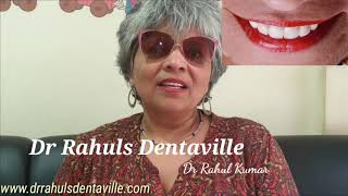 Smile Design in  Thane, Mumbai, India at Dr Rahuls Dentaville