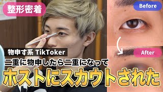 【二重整形・埋没法のリアル】超人気TikTokerガリレオ様のダウンタイムの毎日の経過を大公開！！