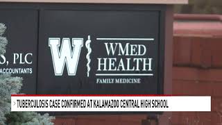 Tuberculosis case confirmed at Kalamazoo school, health officials launch investigation