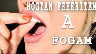 FOGAT FEHÉRÍTEK | FOGFEHÉRÍTÉS, AMIT OTTHON VÉGEZHETSZ, AVAGY HOGYAN LESZ FEHÉR FOGSOROM | VIVANITA