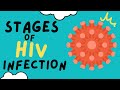 THE 3 STAGES OF HIV INFECTION - EXPLAINED IN UNDER 5 MINUTES