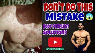 How To Get Rid Of This Type Of Pimples | Pankaj Verma Fitness | Must Watch
