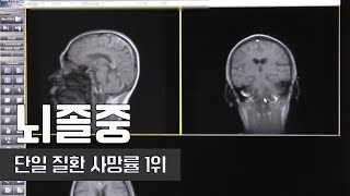 단일 질환사망률 1위, 뇌졸중 | 빠른 시일 내에 치료 받아야 한다! | 건강플러스