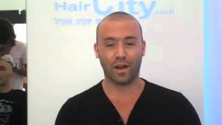 טיפול בהתקרחות לגברים לשיער דליל וירטואלי