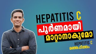 Hepatitis C പൂർണമായി മാറ്റാനാകുമോ ?