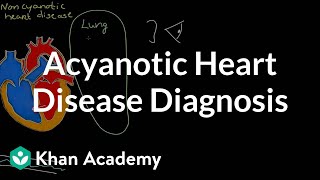 Acyanotic heart disease diagnosis | Circulatory System and Disease | NCLEX-RN | Khan Academy