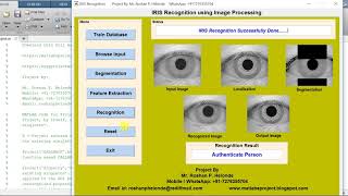 Iris Recognition Using Image Processing Matlab Project Source Code | Human Iris Recognition System
