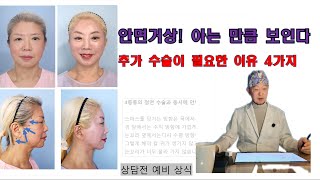 안면거상 아는 만큼 보인다