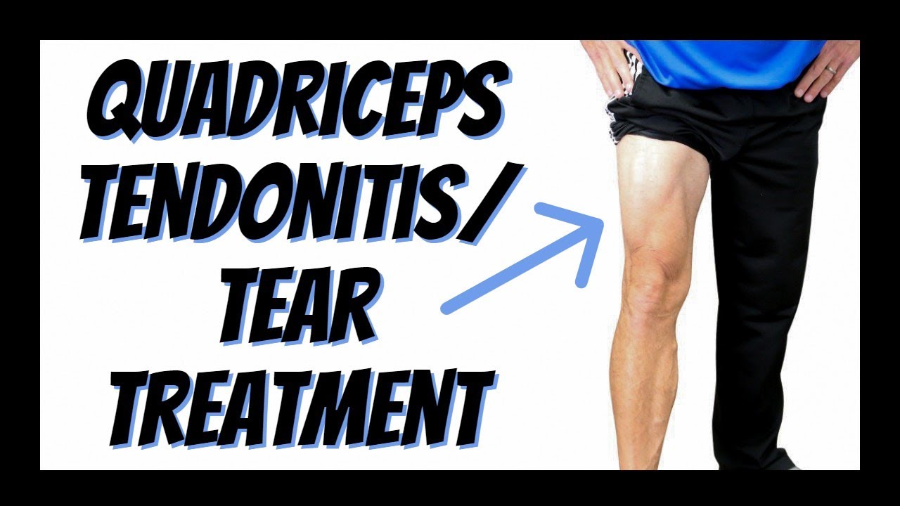 Quadriceps Tendon Pain Exercises Deals Cheap Www Pinnaxis