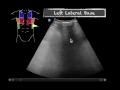 pocus case shortness of breath case 2