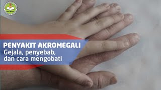 Penyakit akromegali