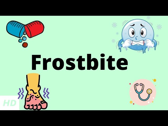 Hand Frostbite Animation