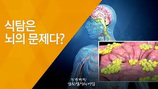 식탐은 뇌의 문제다? - (2014.5.21_503회 방송)_먹고 또 먹고 식탐의 경고