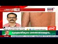 കോവിഡ് പ്രതിരോധത്തില്‍ പ്രതീക്ഷയായി ivermectin പത്തനംതിട്ടയിലും മരുന്ന് ഉപയോഗിച്ച് ഫലം കണ്ടു