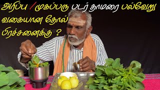 அரிப்பு | முகப்பரு | படர் தாமரை பல்வேறு வகையான தோல் நோய் 🦠பிரச்சனைக்கு ? #skincare #allergy  Disease