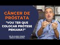 PRÓTESE PENIANA EM CASOS DE CÂNCER DE PRÓSTATA | Dr. Élio Arão Júnior #protesepeniana