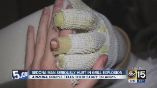 Sedona man seriously injured in grill explosion