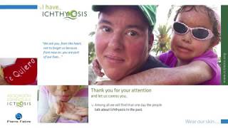 Live with Ichthyosis