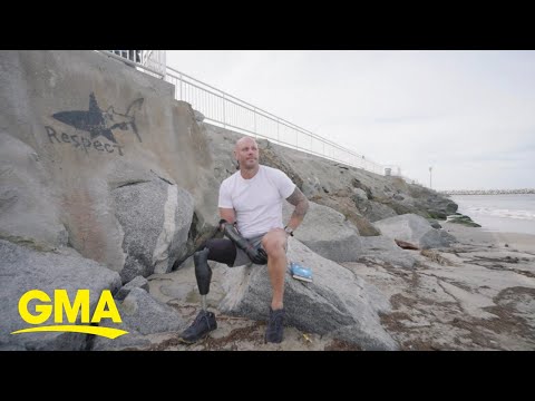 Shark Attack Survivor Shares His Story The Global Herald
