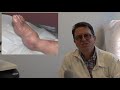 vid5 what is the difference between a semi orthopaedic and an orthopaedic shoe