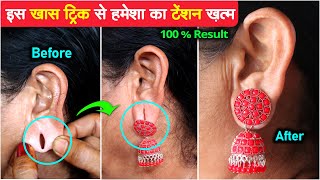 बिना सर्जरी हमेशा के लिए - कान का छेद छोटा करे | Kan ke Ched Chote karne ke upay, ear Hole Size Tips