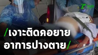 ยายวัย 93 ปี กินเงาะติดคออาการปางตาย | 23-05-63 | ข่าวเช้าไทยรัฐ เสาร์-อาทิตย์